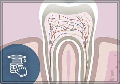 Guide to Root Canals