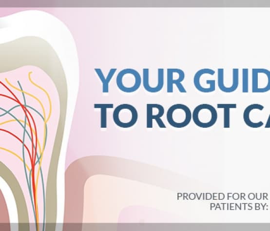 Guide to Root Canals